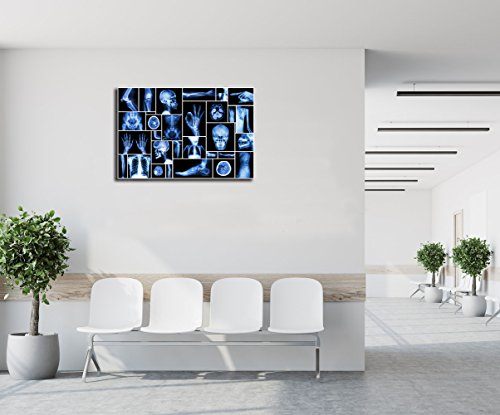KLVOS Large Abstract Skull Canvas Art Wall Decor Black and Blue Collection Xray Multiple Part of Human Organs Gallery Wrap Canvas Prints Home Decor Giclee Print for Hospital Office Ready to Hang