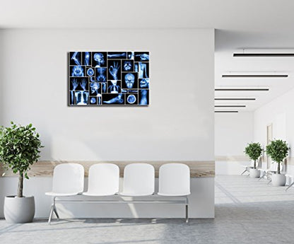 KLVOS Large Abstract Skull Canvas Art Wall Decor Black and Blue Collection Xray Multiple Part of Human Organs Gallery Wrap Canvas Prints Home Decor Giclee Print for Hospital Office Ready to Hang