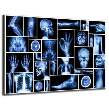 KLVOS Large Abstract Skull Canvas Art Wall Decor Black and Blue Collection Xray Multiple Part of Human Organs Gallery Wrap Canvas Prints Home Decor Giclee Print for Hospital Office Ready to Hang