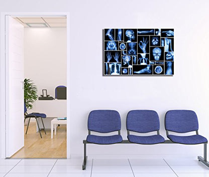 KLVOS Large Abstract Skull Canvas Art Wall Decor Black and Blue Collection Xray Multiple Part of Human Organs Gallery Wrap Canvas Prints Home Decor Giclee Print for Hospital Office Ready to Hang