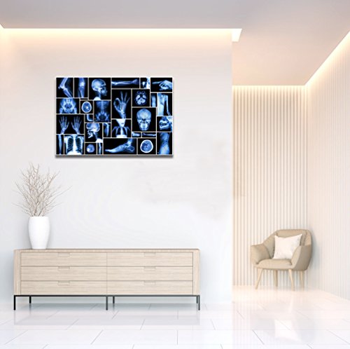 KLVOS Large Abstract Skull Canvas Art Wall Decor Black and Blue Collection Xray Multiple Part of Human Organs Gallery Wrap Canvas Prints Home Decor Giclee Print for Hospital Office Ready to Hang